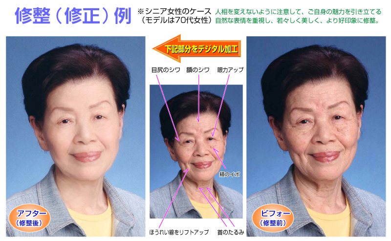 しみ・シワ・たるみを修整
